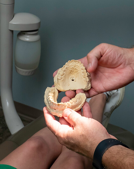 tooth mold used to show patient's how Big River Dental can help restore smiles